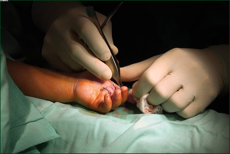 Фото жизнь (light) - Arkady Golod - МЕДИКОГРАФИЯ - Руки друга